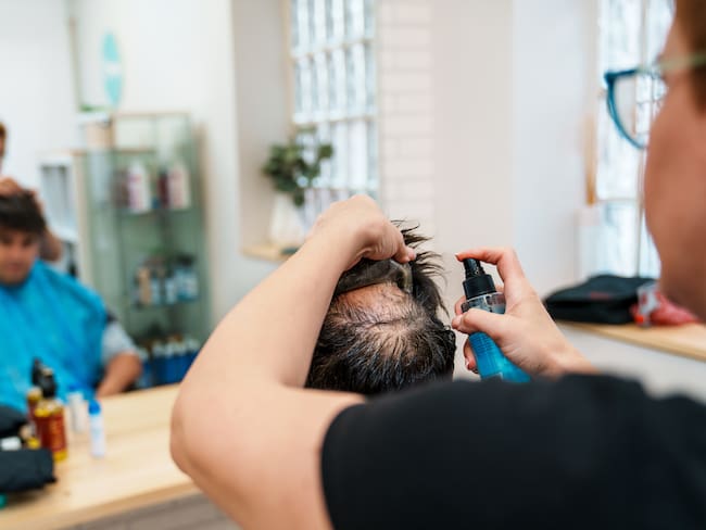 ¿Hay causas diferentes entre la caída del pelo en hombres y mujeres? Especialista explicó