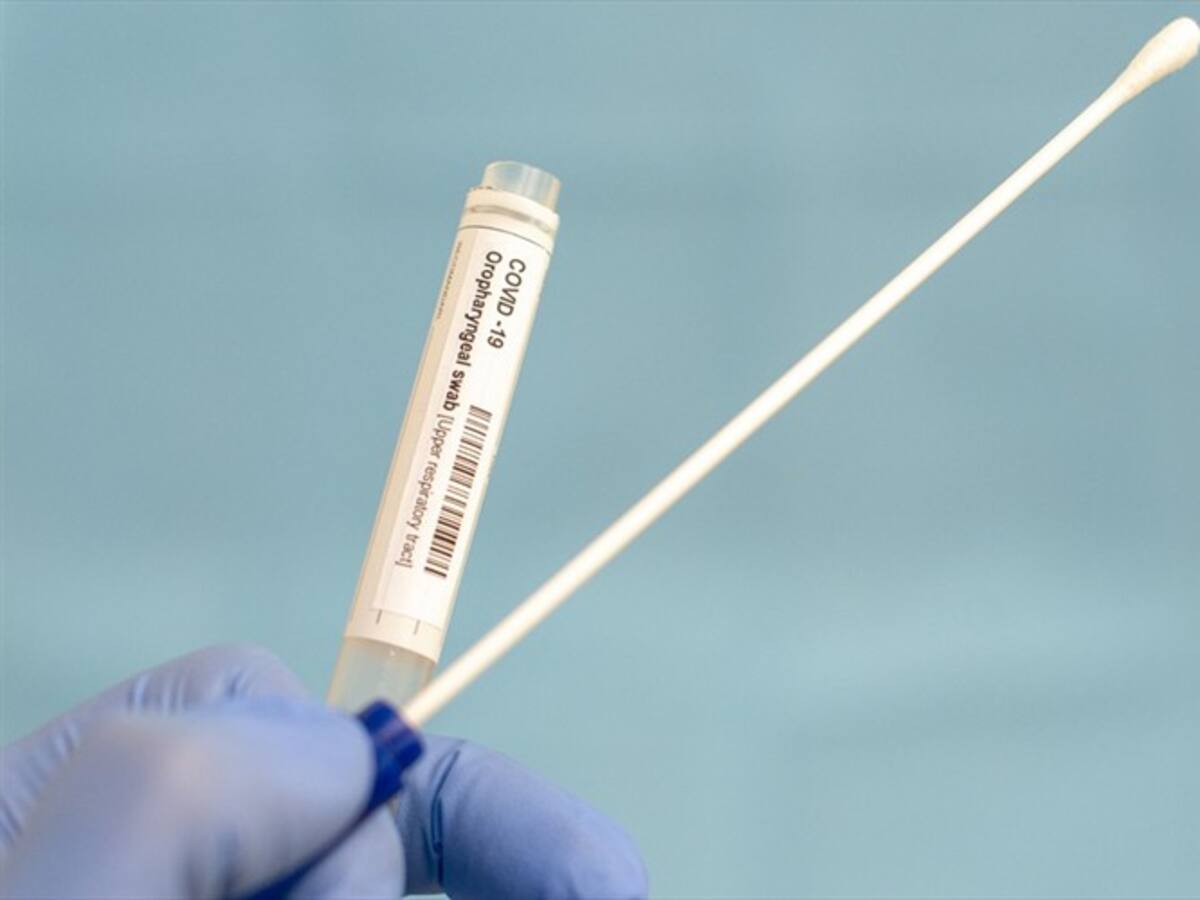 Deportivo Cali confirma su primer caso de coronavirus