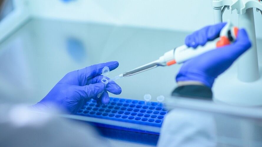 El virólogo Jeremy P. Kamil explicó en Sigue La W que esta variante es más contagiosa. . Foto: Getty Images