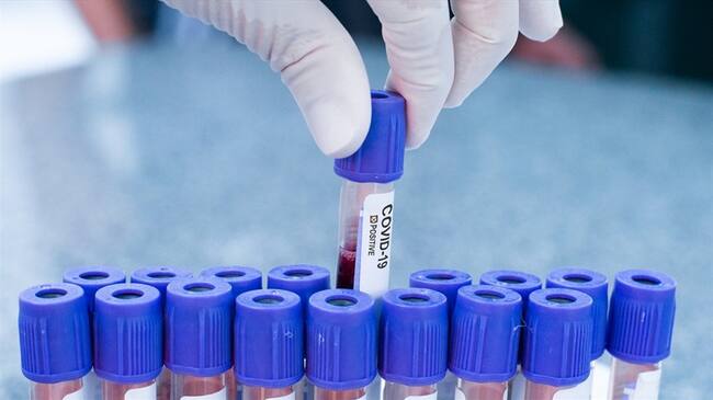 Casos de COVID-19 en Colombia. Foto: Getty Images