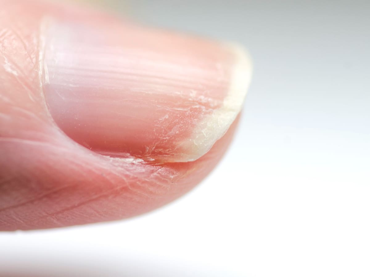 Las razones por las que aparecen manchas blancas en las uñas