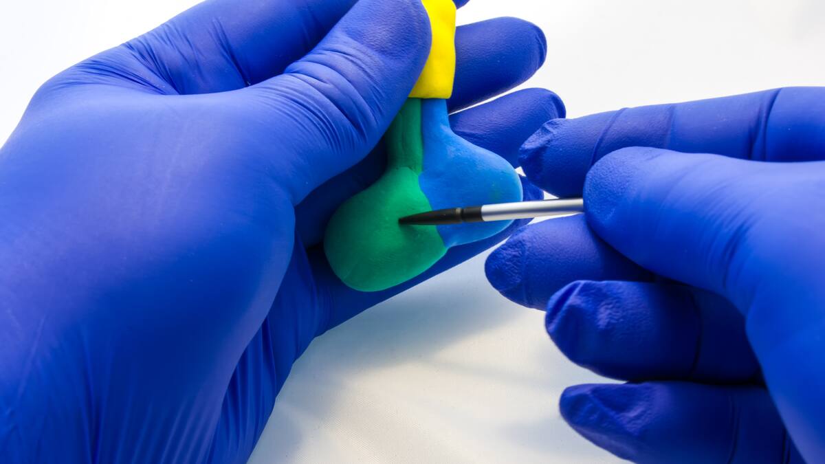 Acromegalia: ¿qué es y cómo diferenciarla del gigantismo?