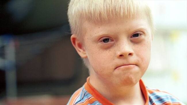 ¿Qué harías si te enteraras de que tu hijo va a nacer con síndrome de Down?. Foto: BBC Mundo