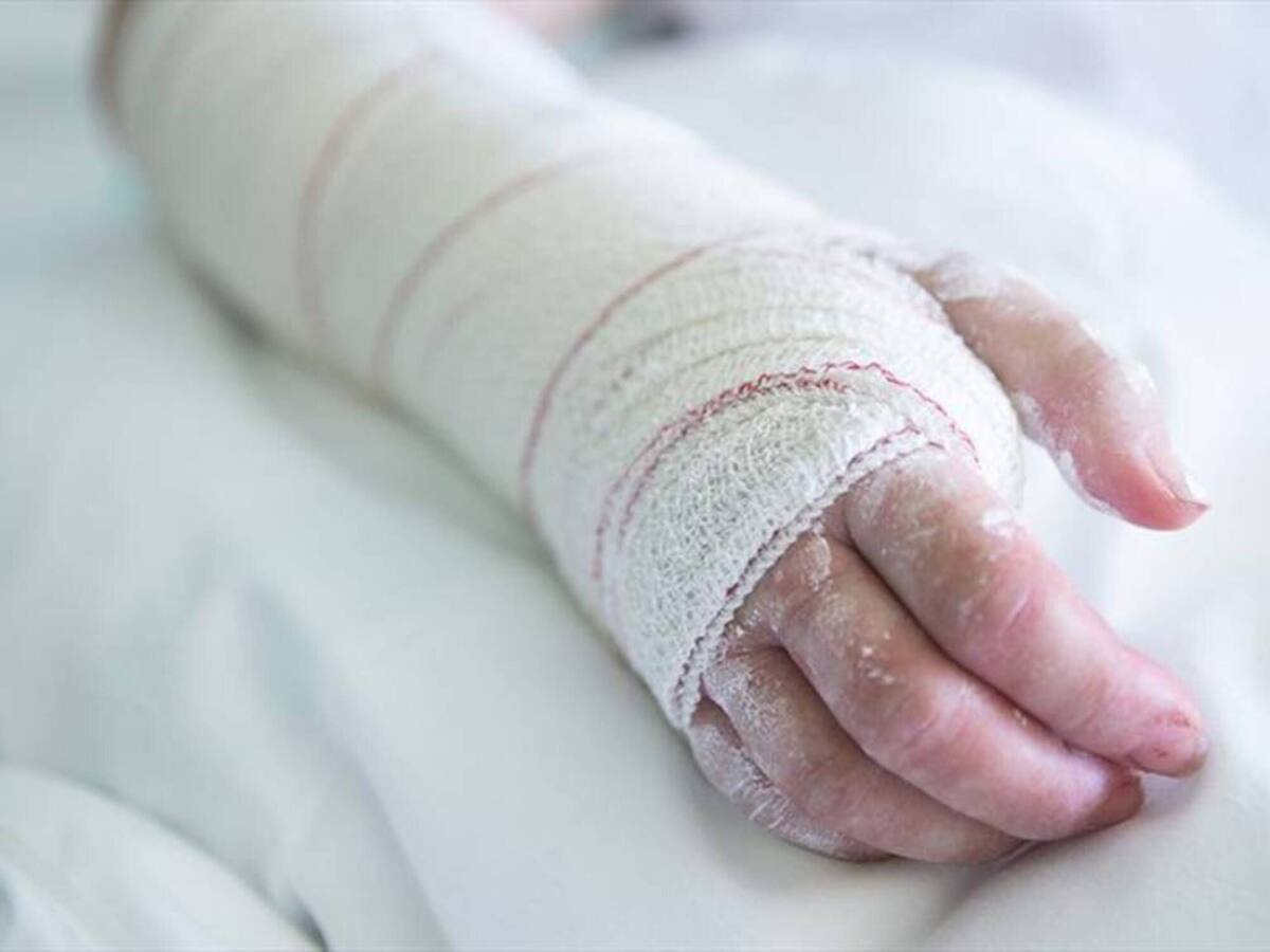 Murió menor al caer a un horno clandestino en Santa Marta: autoridades investigan