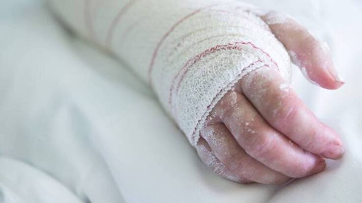 Murió menor al caer a un horno clandestino en Santa Marta: autoridades investigan