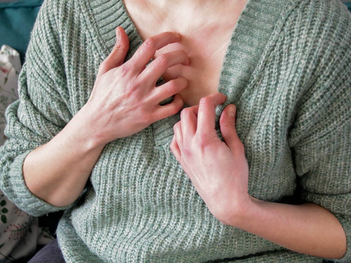 ¿Cómo saber si es alérgico a picaduras de insectos?