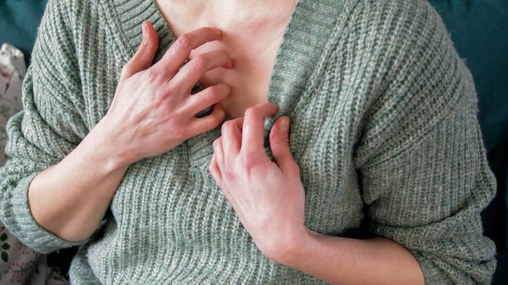 ¿Cómo saber si es alérgico a picaduras de insectos?