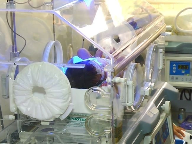 Menor de seis meses murió en medio de un incendio en su vivienda en el Magdalena. Imagen de referencia. Foto: Colprensa