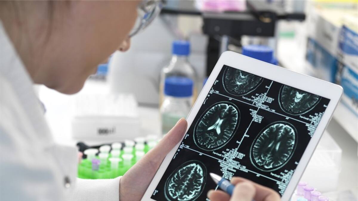 ¿Es posible frenar la progresión del Alzheimer? Esto revela un estudio
