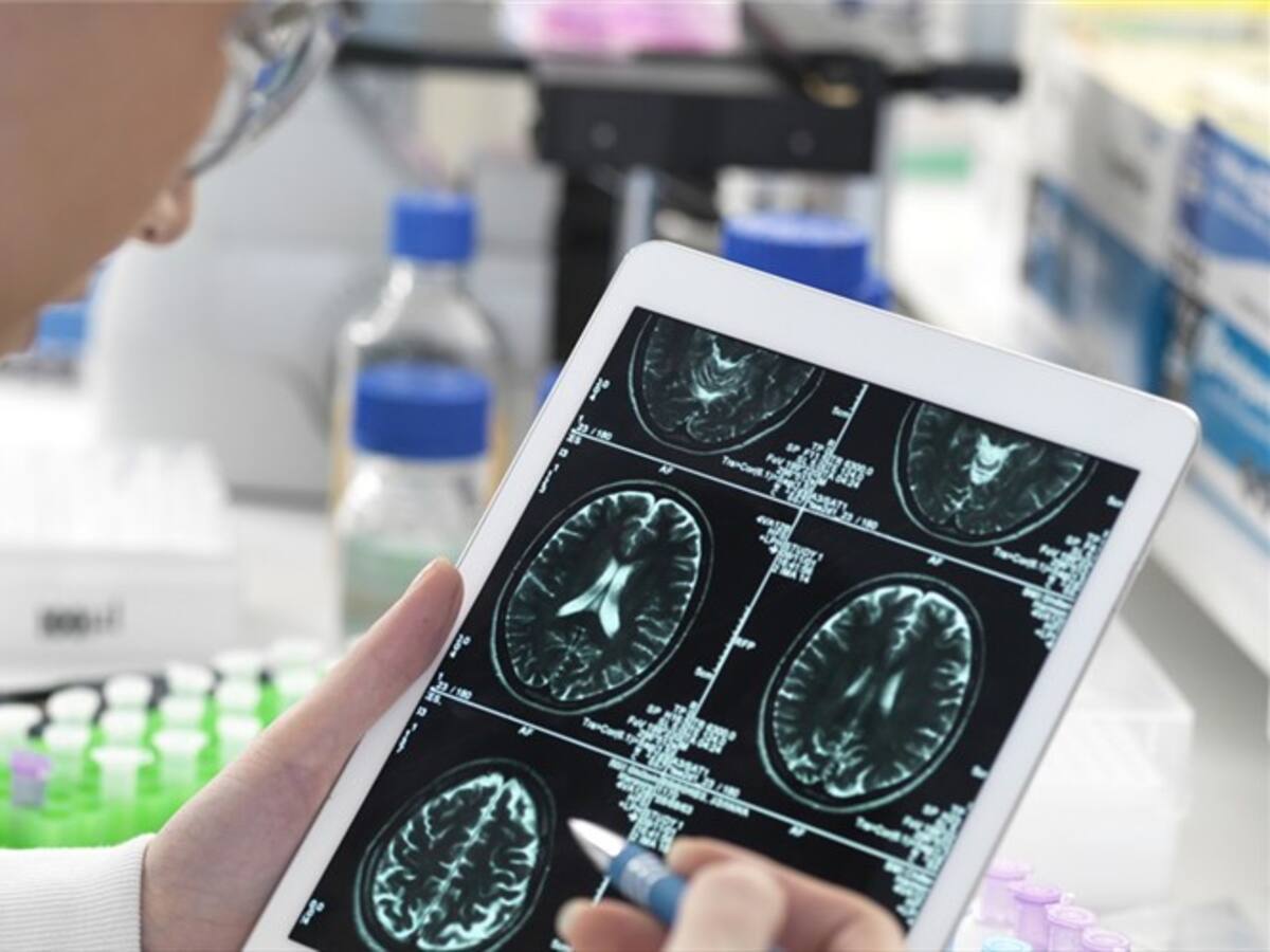 ¿Es posible frenar la progresión del Alzheimer? Esto revela un estudio