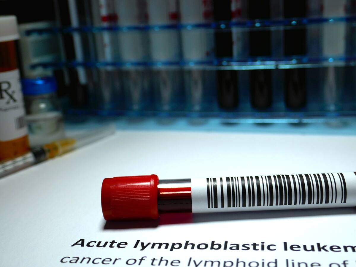 ¿Qué es la leucemia linfoblástica? Hematóloga explicó síntomas, causas y tratamientos