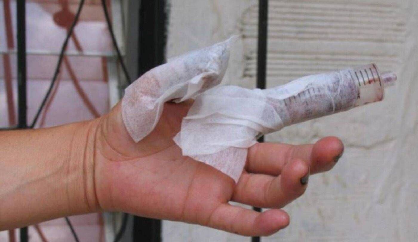 Aumentó el número de quemados frente al año anterior en el Atlántico. Crédito: Colprensa.