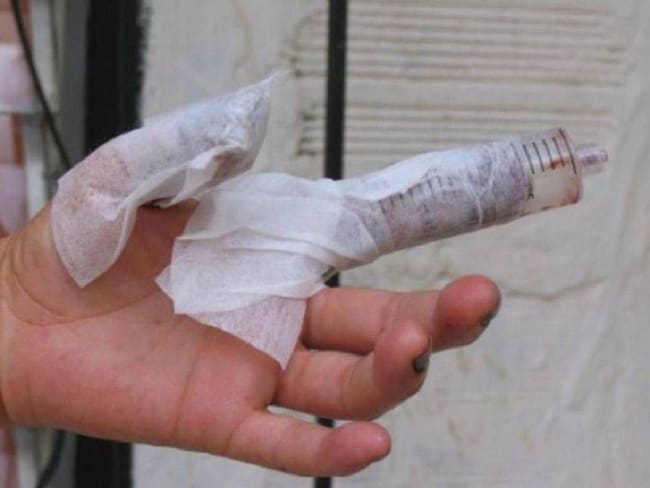 Aumentó el número de quemados frente al año anterior en el Atlántico. Crédito: Colprensa.