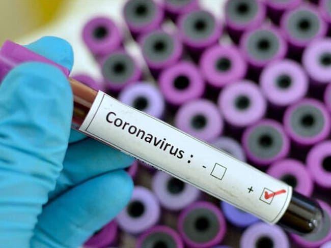 Minsalud confirma dos nuevos casos de coronavirus en el Atlántico