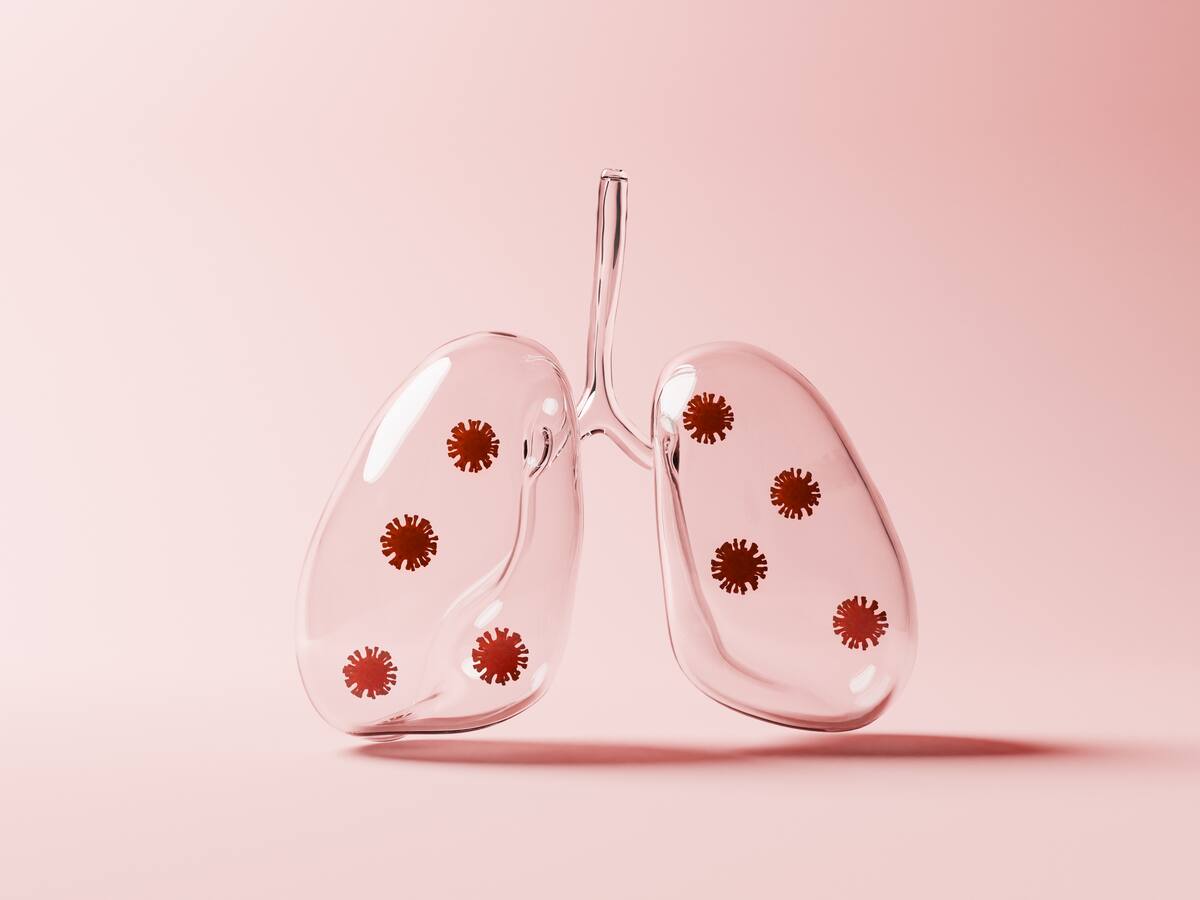 Neumonía: ¿Cómo detectarla y evitar complicaciones? Experto explica