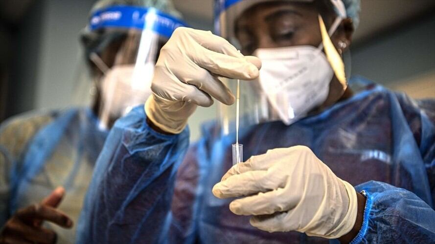 La Administración Distrital ha dispuesto más de 170 puntos para la toma de pruebas para detectar el COVID-19. Foto: Getty Images / CHRISTOPHE ARCHAMBAULT