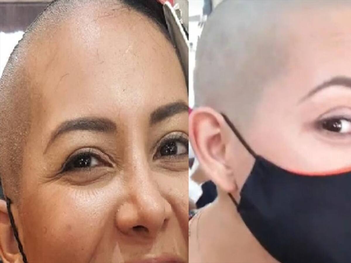 Ángela Hernández y su esposo se rapan en proceso de su quimioterapia