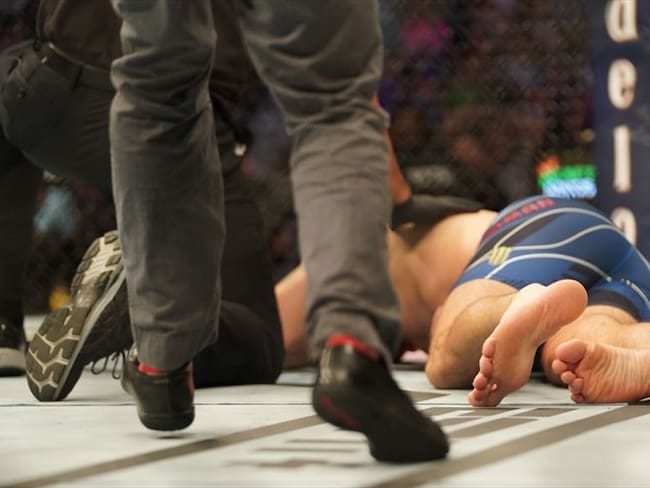 La impactante lesión de Chris Weidman en el UFC. Foto: Getty Images