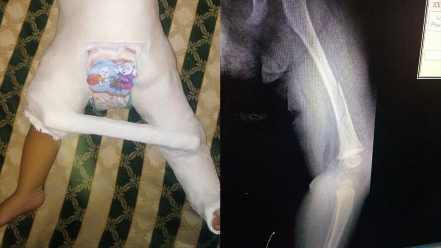 Una bebé de 10 meses fue agredida por una cuidadora de un jardín infantil del sur de Cali. Foto: Erika Rebolledo (W Radio)