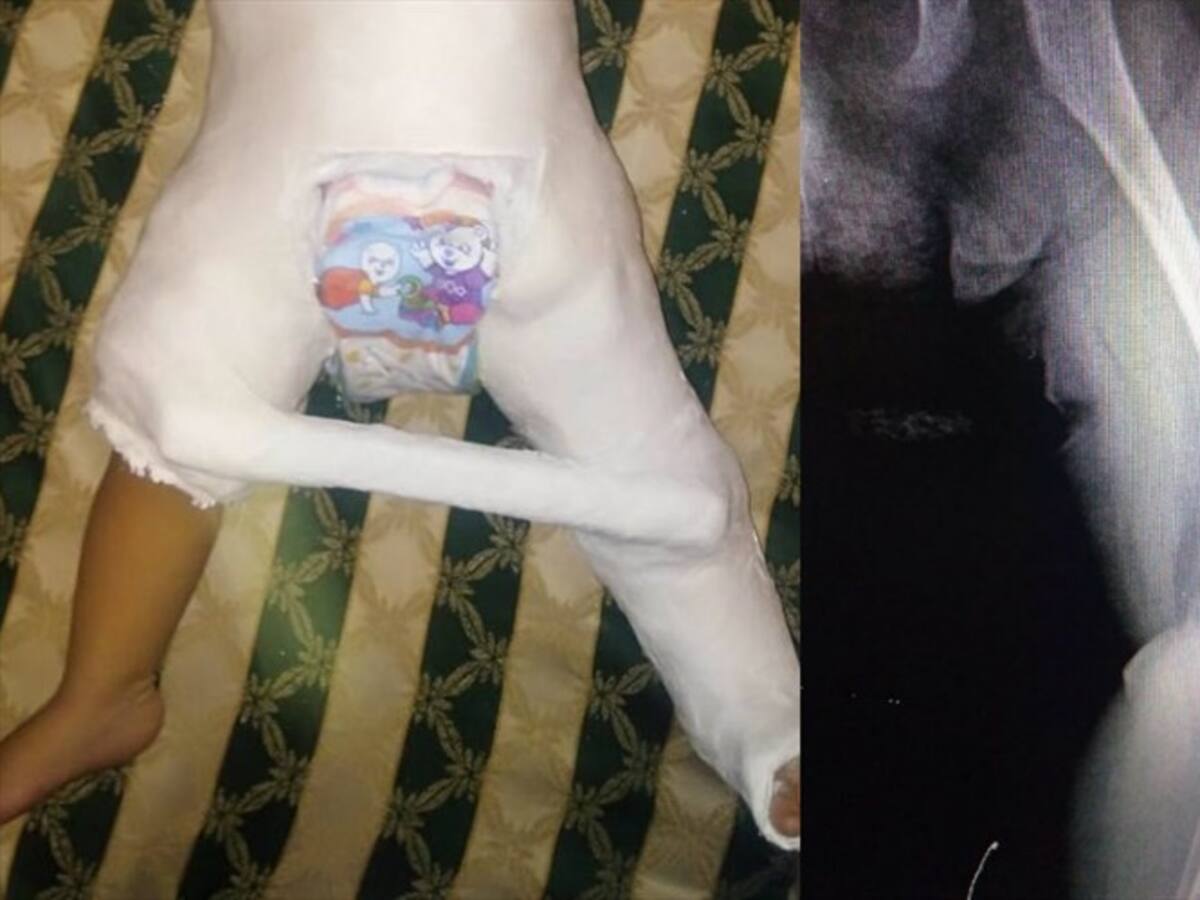 Jardín infantil donde fue agredida una niña de 10 meses no tenía autorización