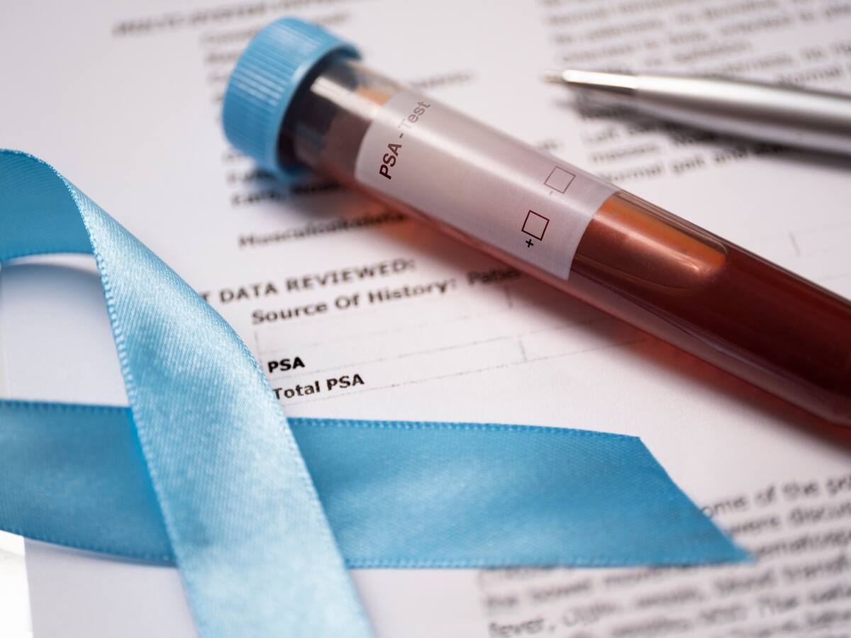 El panorama de Colombia en la prevención y el autocuidado del cáncer de próstata