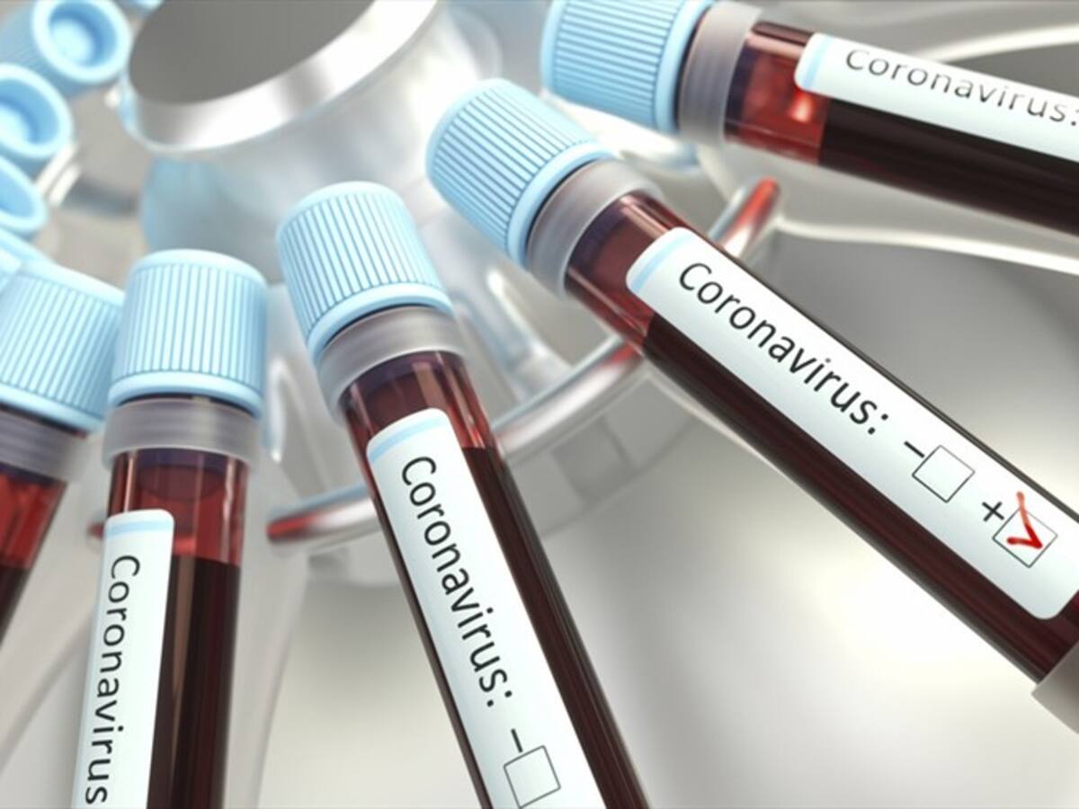 COVID-19 en Colombia: 9.730 casos nuevos y 205 fallecidos para este martes