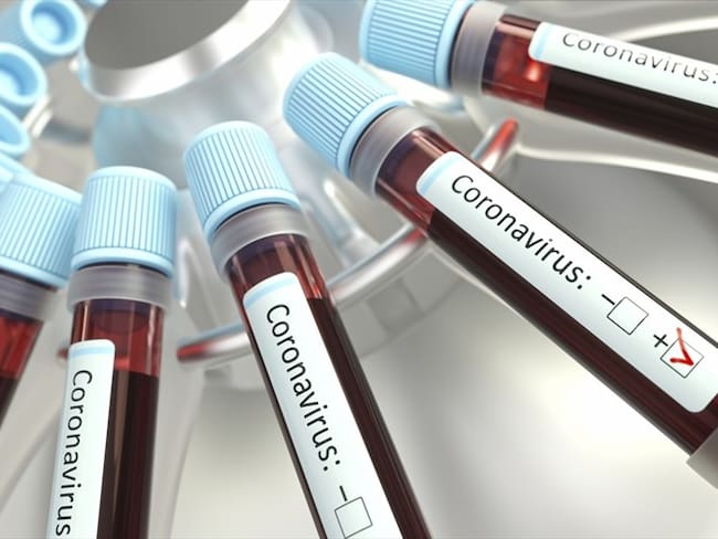 La magnitud del problema del Coronavirus no será diferente a una gripa: Ángel Gil