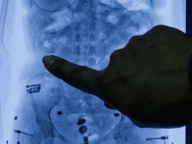 El ciudadano extranjero se encuentra hospitalizado bajo custodia policial. Foto: Colprensa