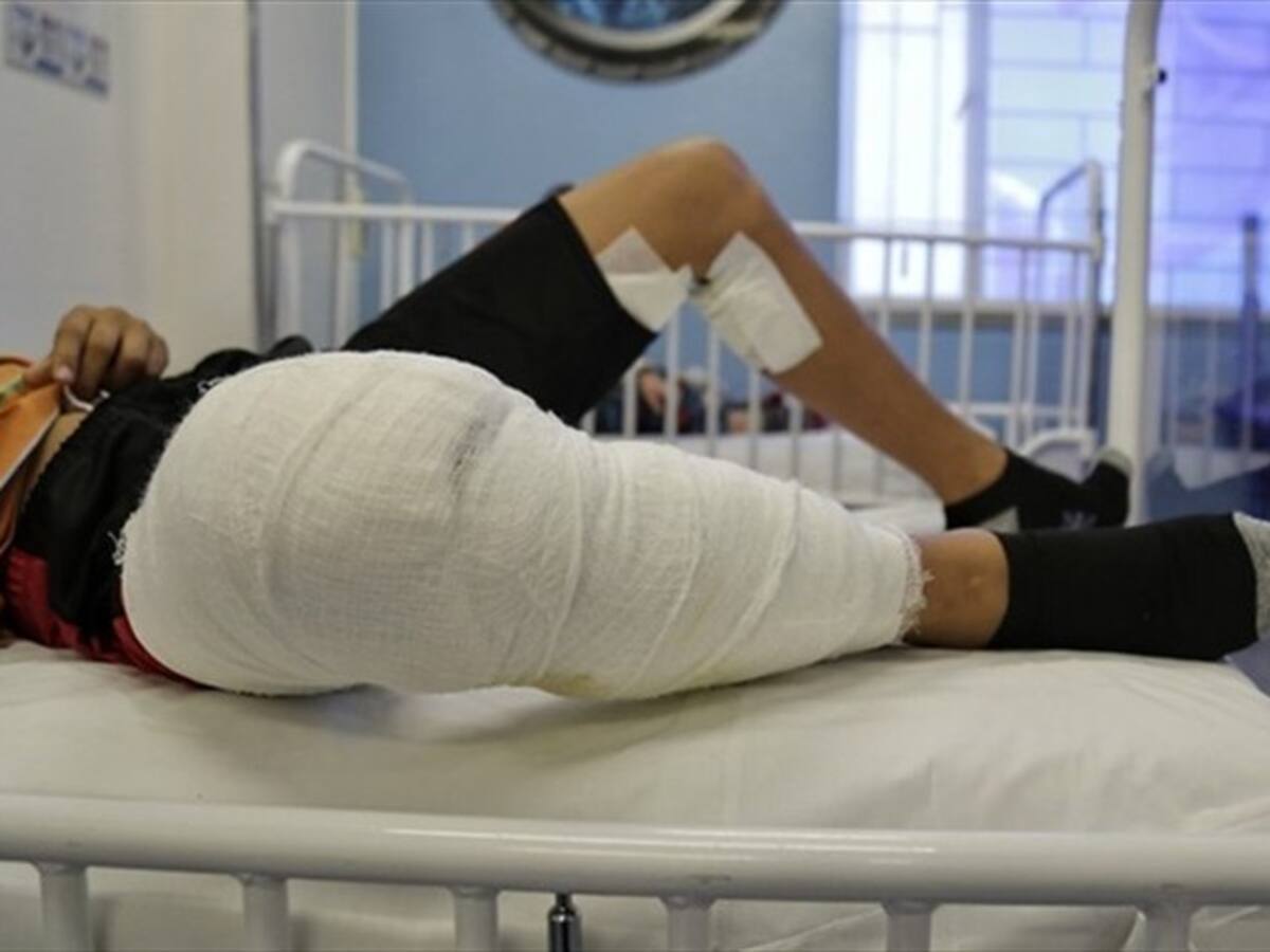 Autoridades de salud entregan cifra de 24 quemados con pólvora en Boyacá