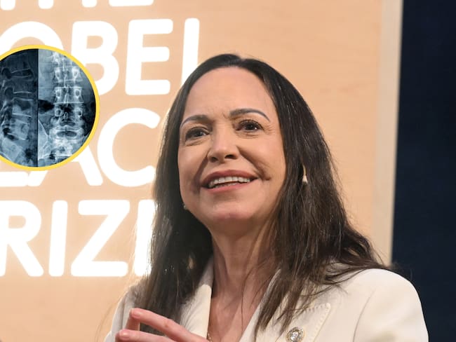 Maria Corina Machado. Foto: Rune Hellestad/Getty ImagesReferencia de fractura vertebral. Foto: Getty Images.