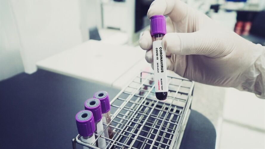 Casos de Coronavirus en Colombia. Foto: Getty Images