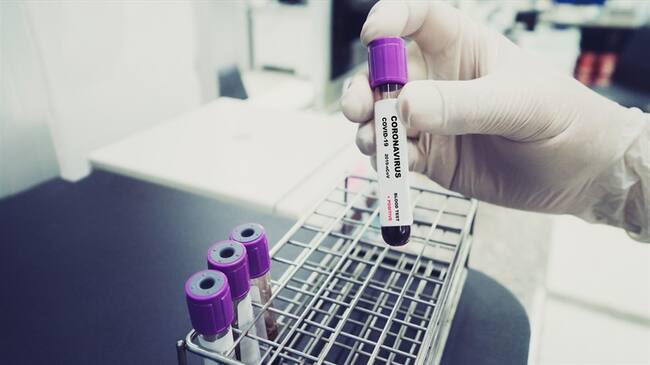 Casos de Coronavirus en Colombia. Foto: Getty Images