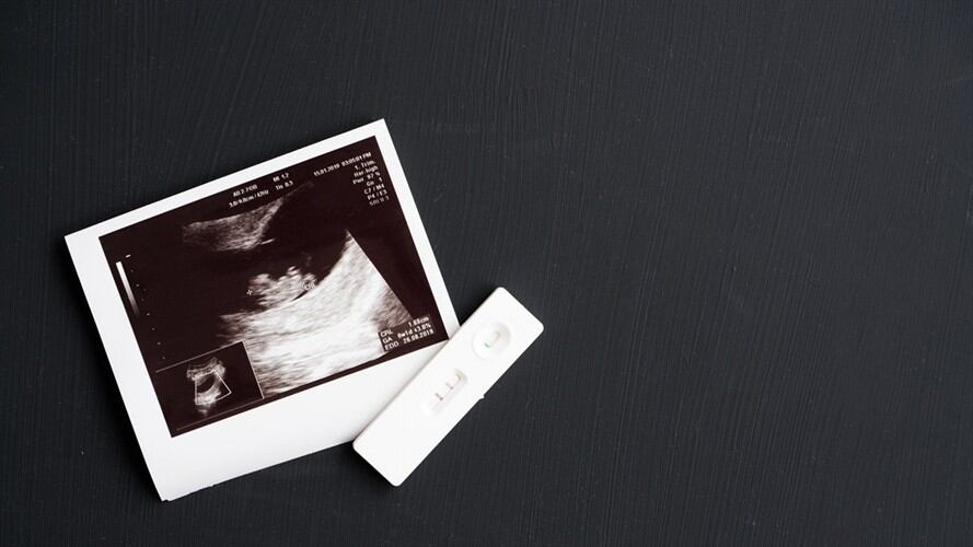 Lina Morales de la Red Jurídica Feminista y la diputada Ángela Hernández, debatieron sobre el proyecto de ley que presentaría la senadora María del Rosario Guerra.. Foto: Getty Images