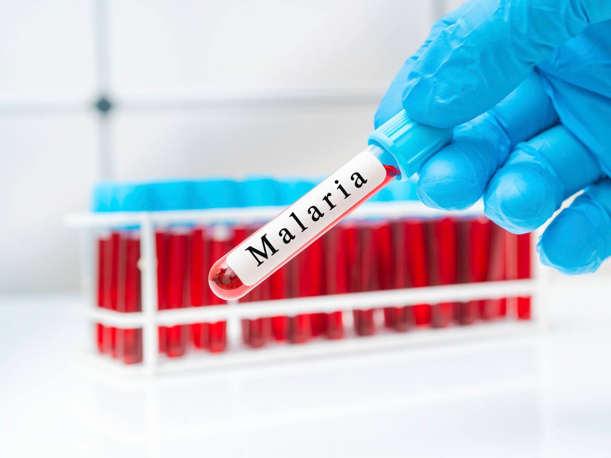 ABC de la malaria explicado por infectólogo: ¿de qué trata?