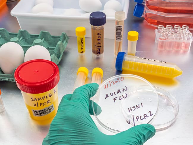 Imagen de referencia de gripe aviar. Foto: Getty Images