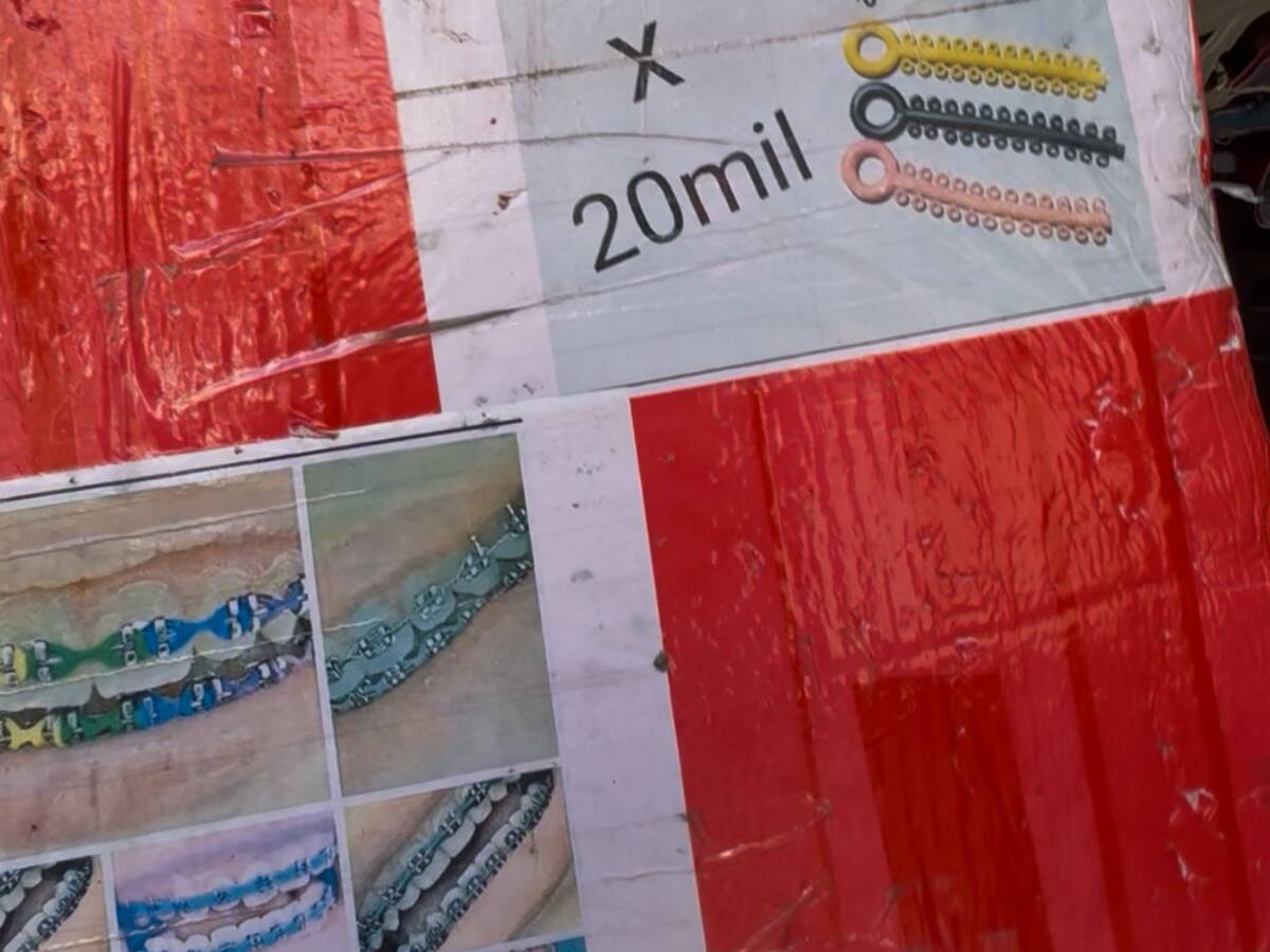 Desmantelan ‘consultorios’ de odontología que operaban en pleno espacio público de Bogotá