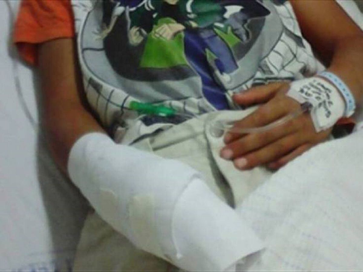 Dos niños quemados por manipulación de pólvora en Cúcuta - Foto: Archivo