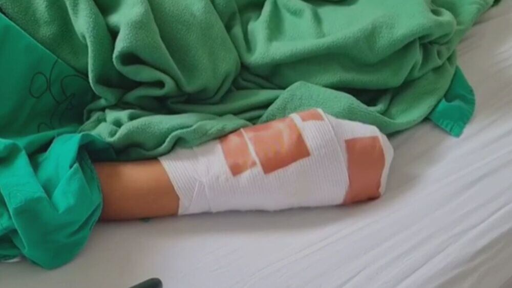 Siete personas resultaron quemadas con pólvora en Santander durante velitas.