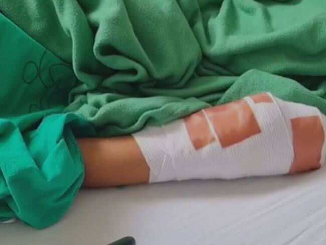 Siete personas resultaron quemadas con pólvora en Santander durante velitas.