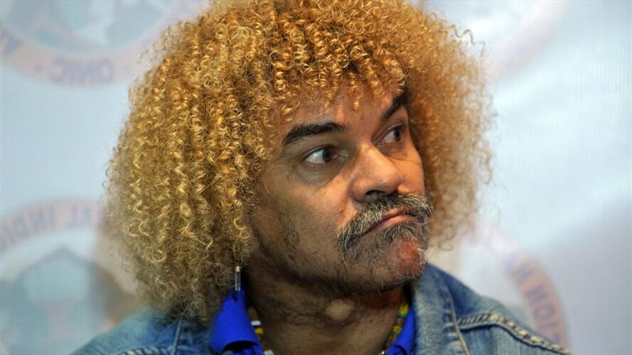 Carlos 'Pibe' Valderrama, exjugador de la Selección Colombia. Foto: Getty Images