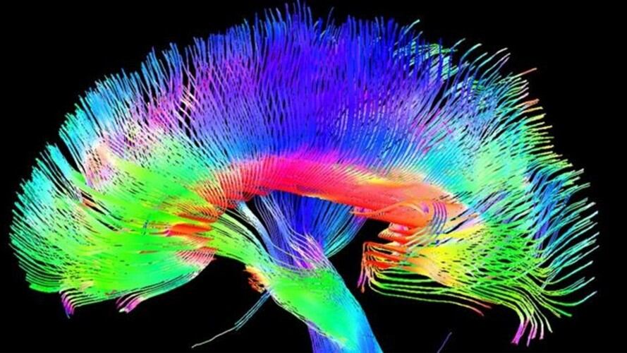¿Son los cerebros humanos simplemente máquinas complejas?. Foto: BBC Mundo