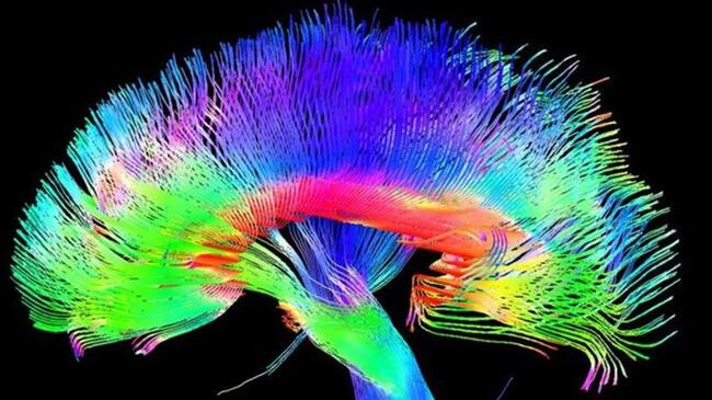 ¿Son los cerebros humanos simplemente máquinas complejas?. Foto: BBC Mundo