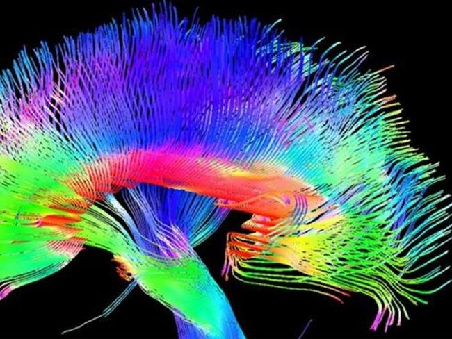 ¿Son los cerebros humanos simplemente máquinas complejas?. Foto: BBC Mundo