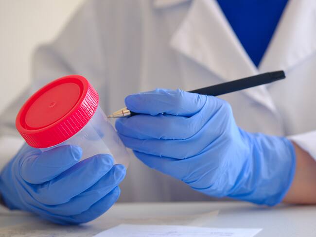 Análisis de espermatozoides / Getty Images