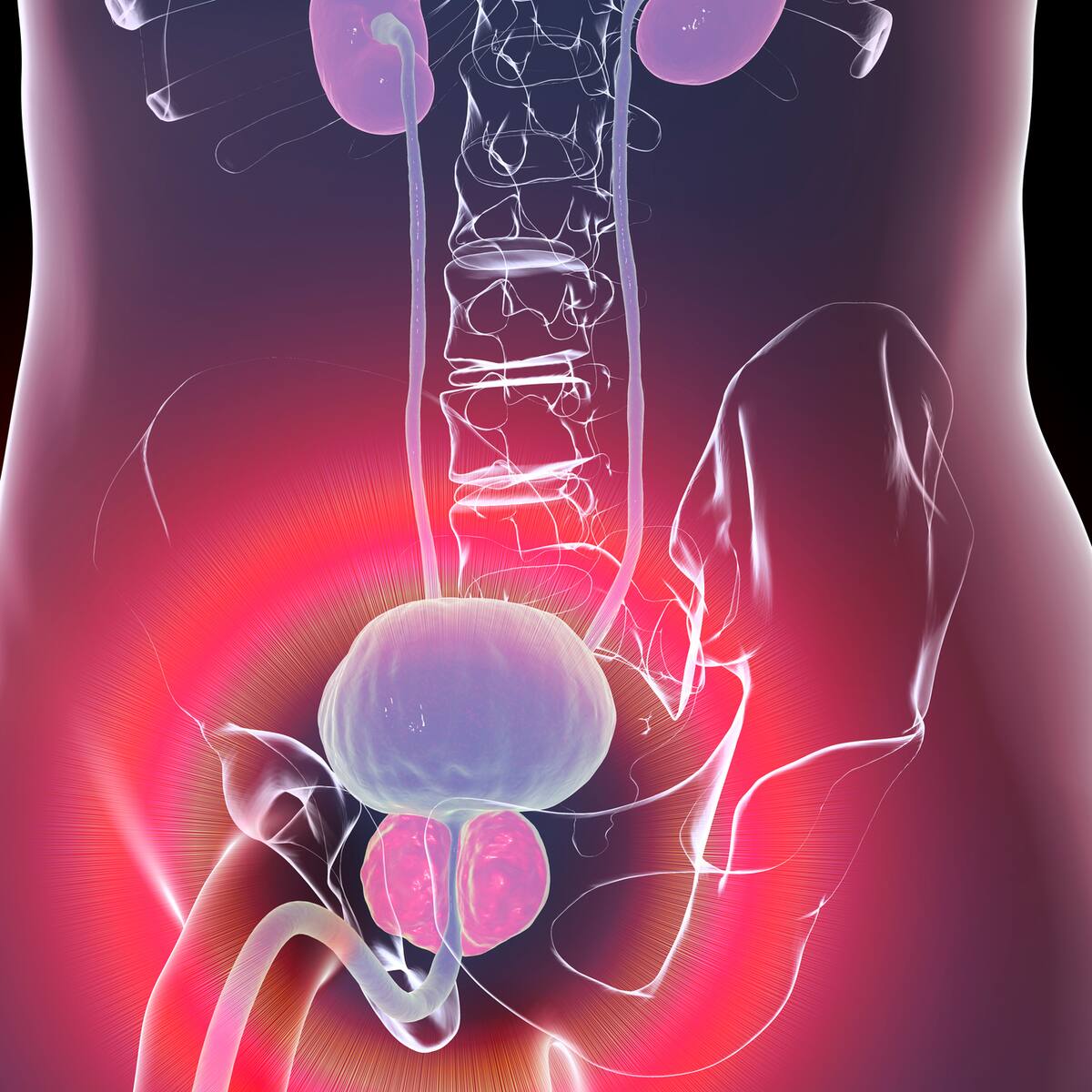 Estos son algunos factores externos que podrían influir para tener cáncer de próstata