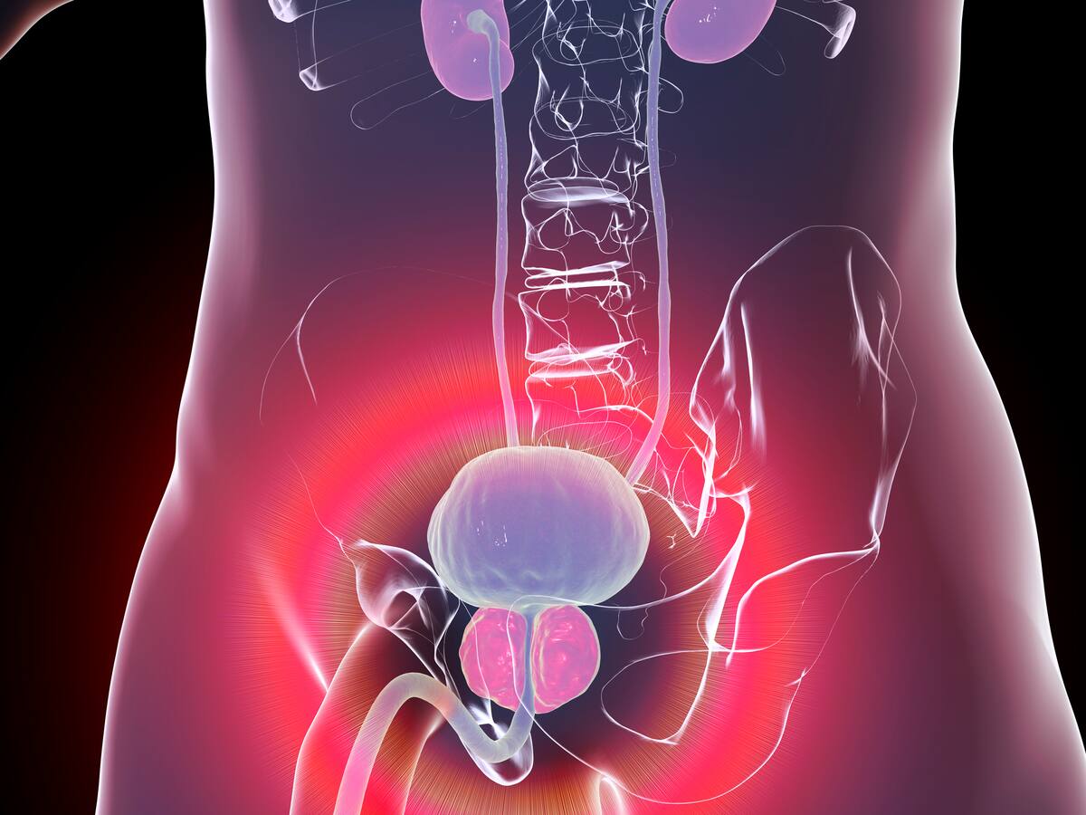 Estos son algunos factores externos que podrían influir para tener cáncer de próstata