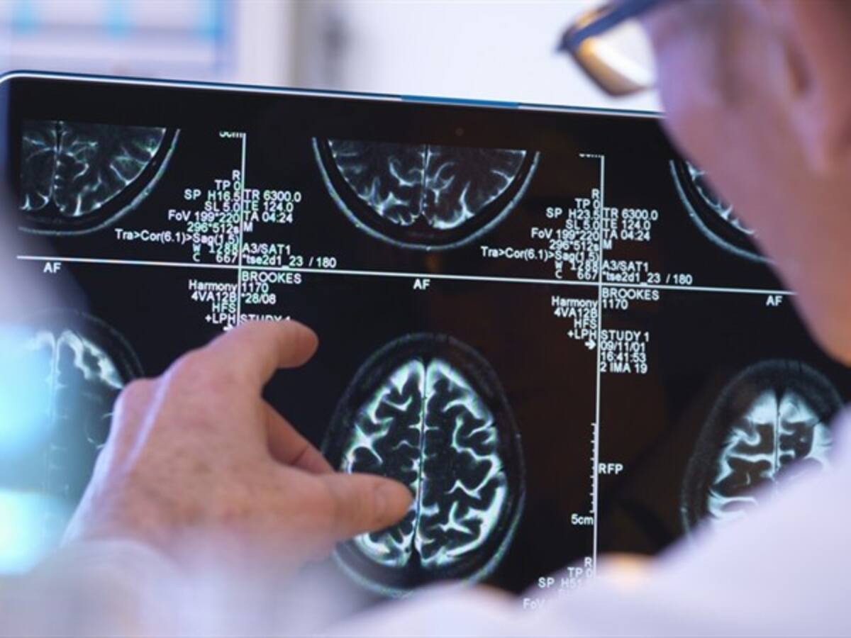 Identifican el gen responsable de una nueva enfermedad neurológica