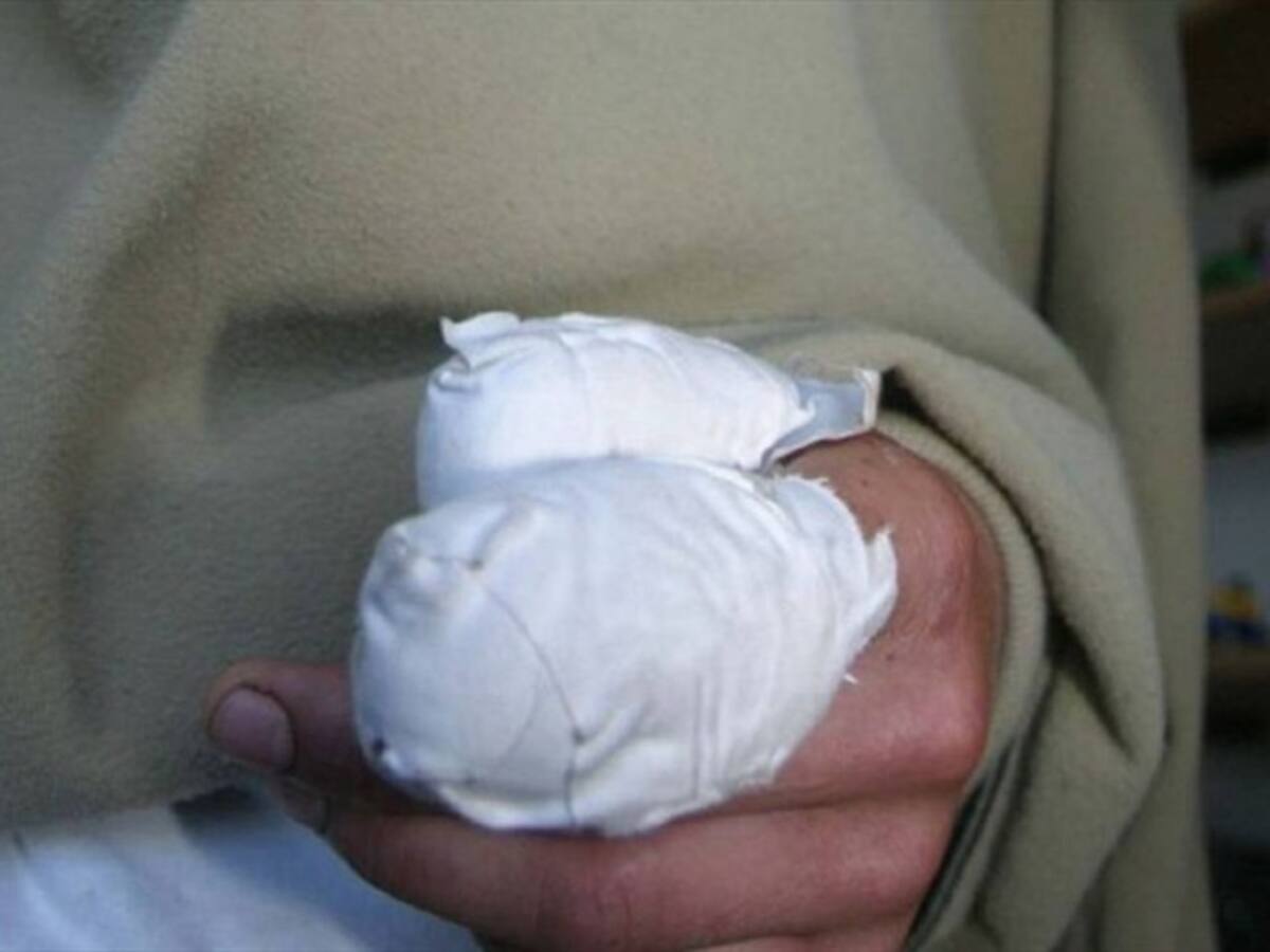 Tres quemados con pólvora en Risaralda durante la noche de Navidad