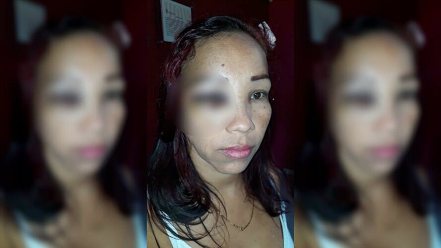 Mujer denuncia agresión por parte de Policías en Malambo, Atlántico. Foto: Cindy Anguila