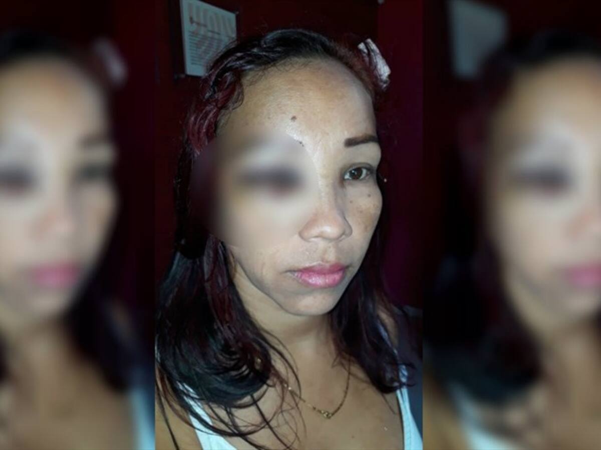 Mujer denuncia agresión por parte de Policías en Malambo, Atlántico
